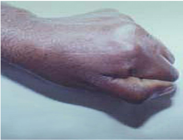 Figure 5